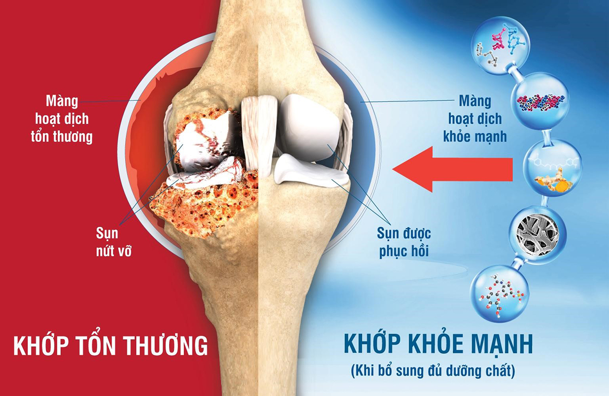 Dấu hiệu nào cảnh báo xương khớp đã 'già'?