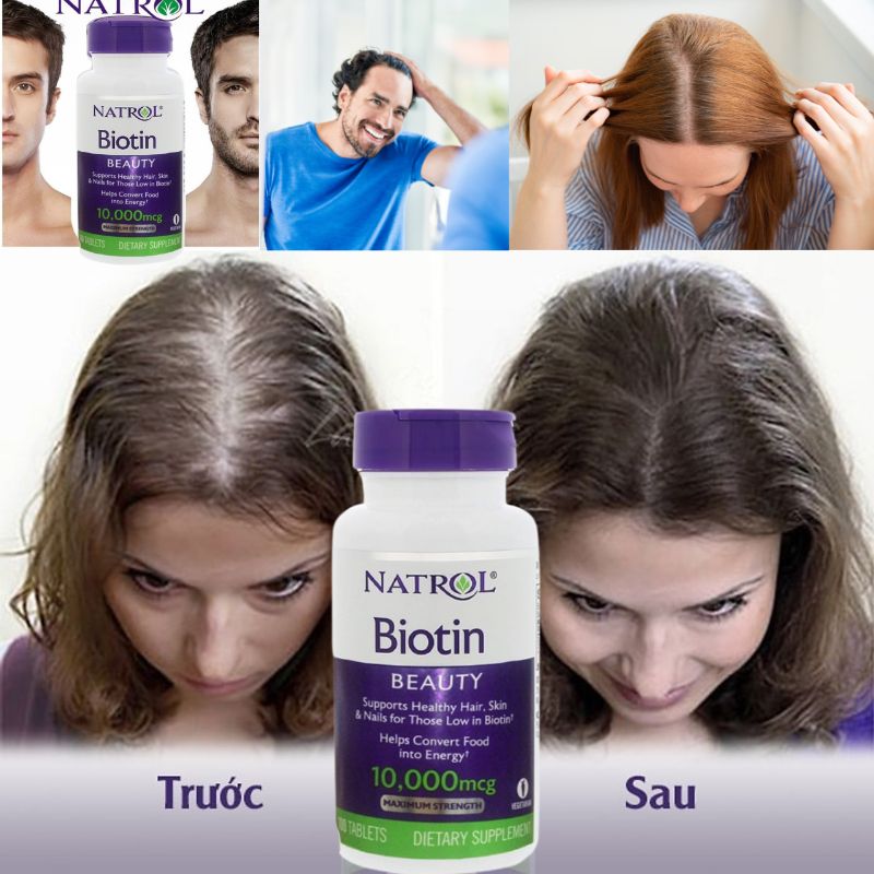 Thực Phẩm Chức Năng Natrol - Viên Uống Mọc Tóc Biotin Beauty 10000 mcg